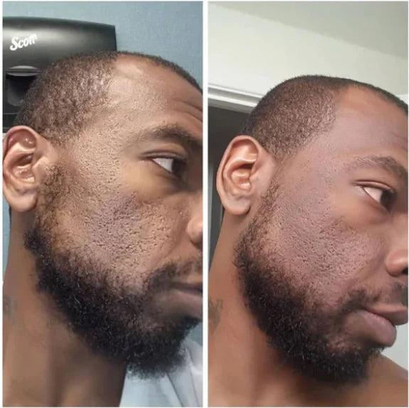 Radiant Blowout Routine Set [TikTok Bestseller]
