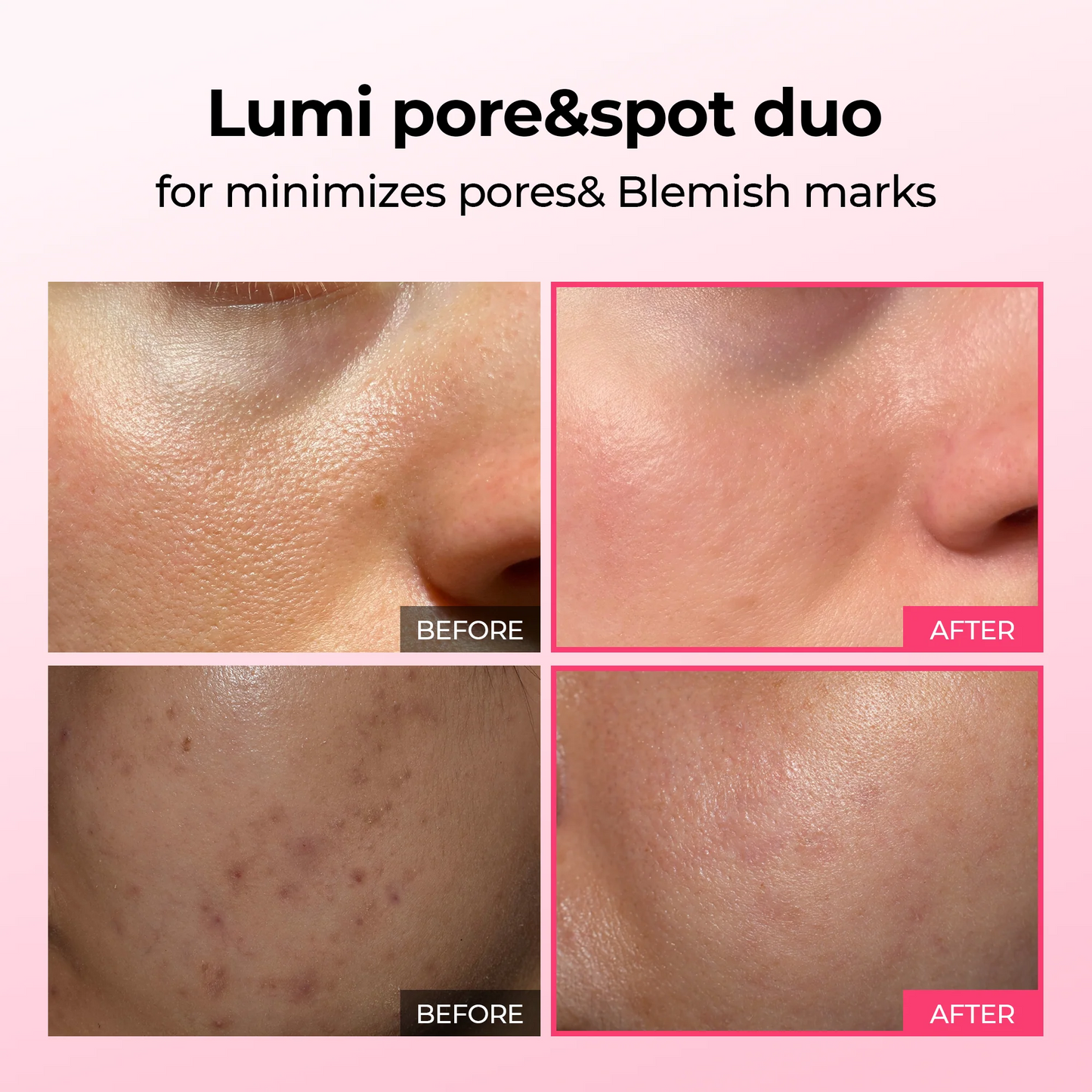 Duo Lift - Cyano Pink + Picotonic Shot